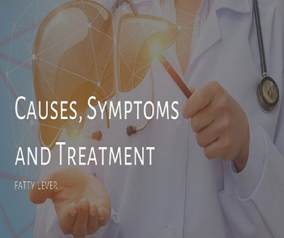 Causes, Symptoms , Treatment of fatty liver.