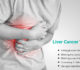 Liver Cancer Symptoms, Causes and Treatment