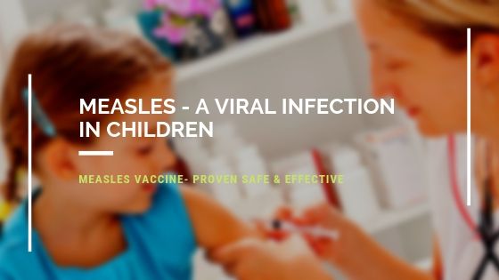 Measles - A Viral Infection in Children