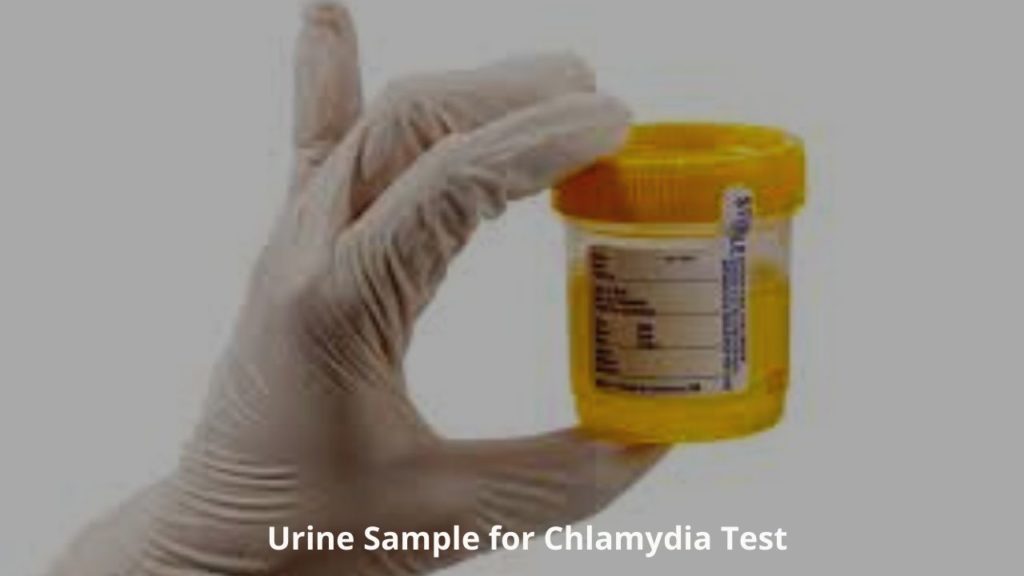 Chlamydia Testing- How Chlamydia Test Is Done? 